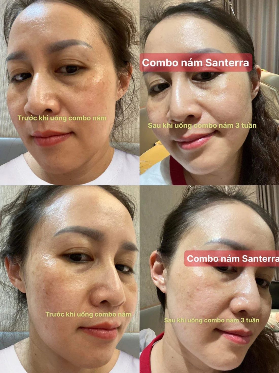 Santerra Skin White Excellence